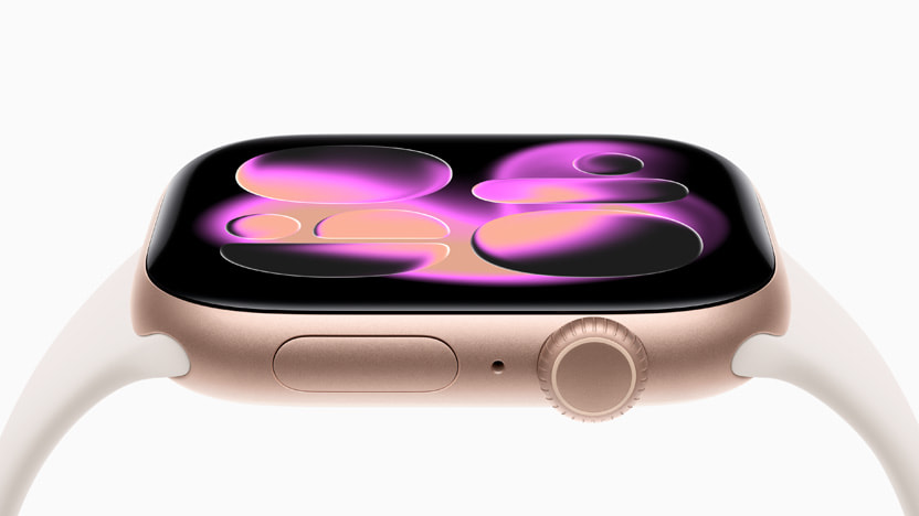 Apple Watch Series 11 thumbnail 2