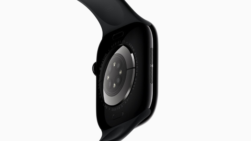 Apple Watch Series 11 thumbnail 5